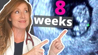 8 Week Ultrasound | PLUS how to Help with Morning Sickness