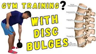 How to Train in the gym with lumbar disc bulges (phase one)