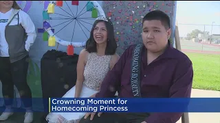 Students Organize To Vote Galt Girl With Williams Syndrome Onto Homecoming Court