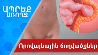 Ապրեք առողջ | Որովայնային ճողվածքներ