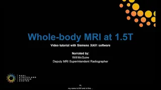 WB-MRI @ 1.5T on Siemens Sola Using XA51 Software