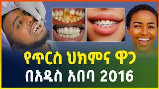የጥርስ ህክምና ዋጋ በአዲስ አበባ 2016 | Teeth whitening Dental Clinic in Addis Ababa Ethiopia | Gebeya