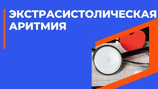 Экстрасистолическая аритмия. Когда необходими лечить экстрасистолию.