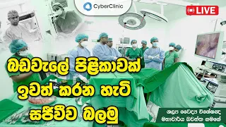 බඩවැලේ පිළිකාවක් ඉවත් කරන හැටි සජීවීව බලමු