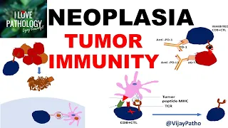 NEOPLASIA 9: TUMOR IMMUNITY: tumor antigens, Evasion of tumor immunity