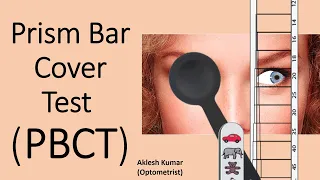 Prism Bar Cover Test | Prism Cover Test | PBCT | PCT | Squint | Strabismus