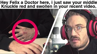 Doctor Reacts To my Injury (serious) - LWIAY #00142