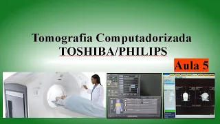 Curso de Tomografia - Aula 5 (Console da Toshiba e Philips)