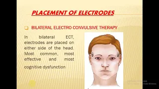 Electroconvulsive therapy By/ Dr . Wafaa Osman