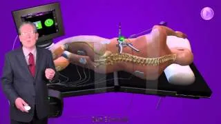 Minimally Invasive Spine Surgery