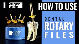 How To Use Dental Rotary Files | SuperEndo