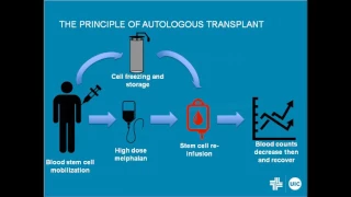 Multiple Myeloma – Is It Now a Curable Disease?