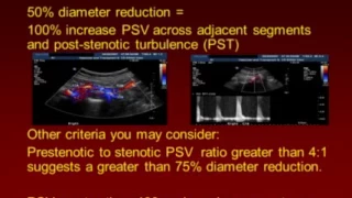 Abdominal Doppler Protocols and Tips