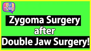 Undergo zygoma(cheekbone) surgery after double jaw surgery!