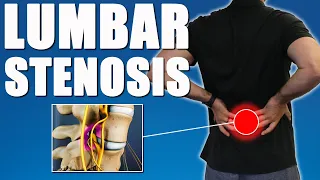 LUMBAR SPINAL STENOSIS.  BEST Exercises, Stretches & Advice for Back & Leg Pain Relief