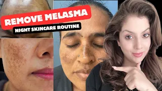 How to treat Melasma | Skincare routine for Melasma | How to apply demean cream | Nipun Kapur