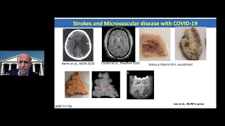 Neurologic Complications of COVID-19