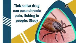 Tick saliva drug can ease chronic pain, itching in people: Study