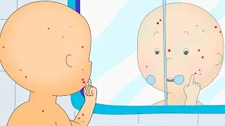 Caillou en Français | Caillou a la Varicelle | dessin animé | dessin animé pour bébé | NOUVEAU 2018