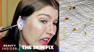 Earwax Cleaner Has Built-in Microscope | The Skin Fix