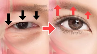 Big Eyes Exercise (Fast Results) | Massage to Lift Droopy Eyelids, Lift Up Eyebrows Naturally