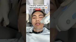 I survived the 3 most painful skin treatments in Korea (PART 2)