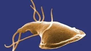 Giardia: What You Should Know