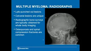 Hematogenous malignancy,Leukemia, lymphoma