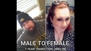 Male to Female - HRT 1 Year Transition Timeline (Pictures)