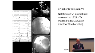 PR2023, MARCH 19 - Ablation of ventricular arrhythmias 2