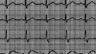 Kardiogram-to jeszcze nie koniec ...Andrzej Poniedzielski
