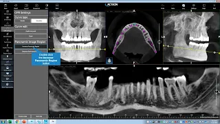 Acteon Imaging Suite 5.0 Full Software Training Video with Lee Davis