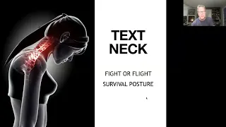 Text Neck: Platysma Muscle Exercise