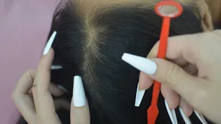 ASMR Tingting Scalp Check, Focus Hair Parting, Hair Sounds, Relaxing For Rest And Deep Sleep