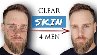 How to GET CLEAR SKIN for MEN || Advanced Skincare Secrets