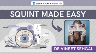 Squint Made Easy | Ophthalmology | NEET-PG 2021 | Vineet Sehgal