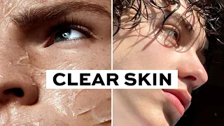 How To Get Clear Skin (only 3 steps)