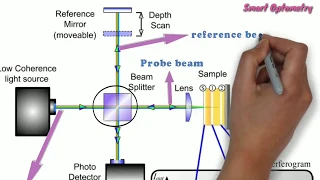 Optical Coherence Tomography - OCT (Full)