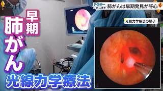 日本人のガン死因第1位…“肺がん”は早期発見が肝心！手術をしない治療法『光線力学療法』も（ドクターおしえて）