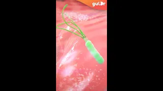 What is Gastritis and H. Pylori? | 3D #Shorts