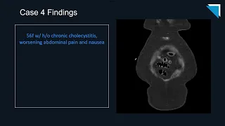 2023 QA Forum Part 3: GI/GU | Free Radiology CME