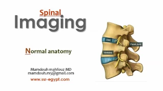 C.T NORMAL SPINE PROF  DR/MAMDOUH MAHFOUZ