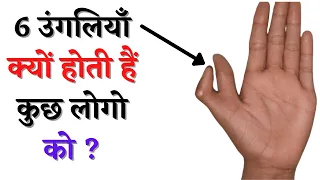 हाथ में 6 उंगलियाँ क्यों होती है | Cause Of 6 Fingers In Hand | Hath Me 6 Ungli Ka Matlab