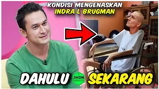 MENGENASKAN, BEGINI KONDISI INDRA L BRUGMAN terkena penyakit mem4tikan❗