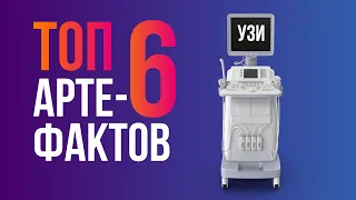 Это нужно знать каждому УЗИ специалисту. Топ 6 артефактов УЗИ. От акустической тени до реверберации