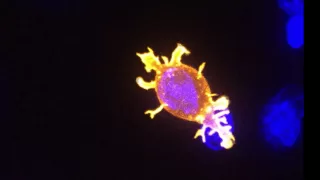 Killer T cell attacking cancer