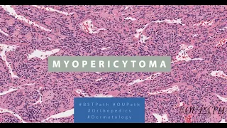 Myopericytoma