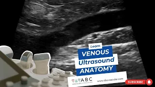 Technical and simple way of Deep veins ultrasound FULL COURSE on www.abcvascular.com and Examination