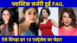 Top 10 TV Actresses जिनकी Plastic Surgery हुई FAIL | Before & After Plastic Surgery SHOCKING LOOK