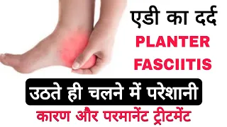 एडी के दर्द से छुटकारा होम्योपैथी द्वारा । पैर के तलवे का दर्द । what is planter fasciitis ।